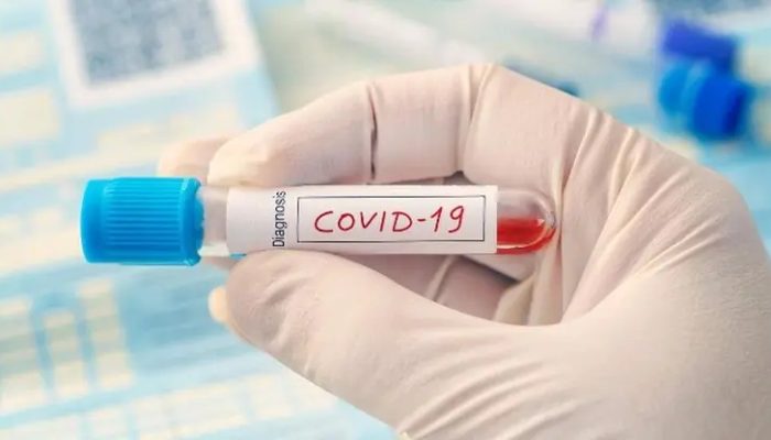 8 Karyawan PT Tokai Positif Covid-19, Disnaker Depok: Perusahaan Harus Rapid Test Antigen Masal